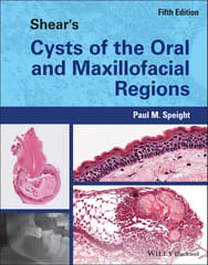 Shear's Cysts of the Oral and Maxillofacial Regions 5th Edition 2022