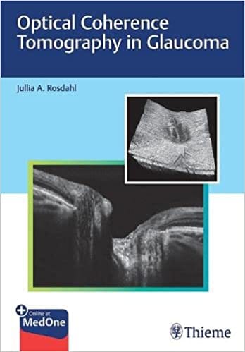 Rosdahl Optical Coherence Tomography in Glaucoma 1st Edition 2021