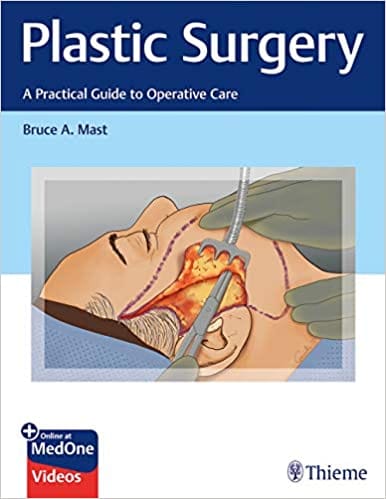 Mast Plastic Surgery : A Practical Guide to Operative Care 1st Edition 2020