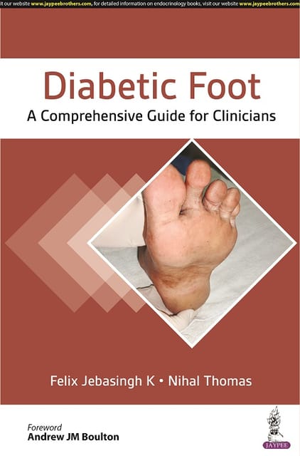 Felix Jebasingh K Diabetic Foot A Comprehensive Guide for Clinicians 1st Edition 2022