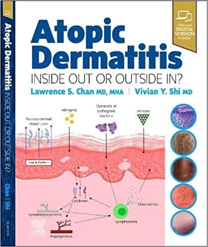 Chan L S Atopic Dermatitis Inside Out Or Outside In? With Access Code 2023