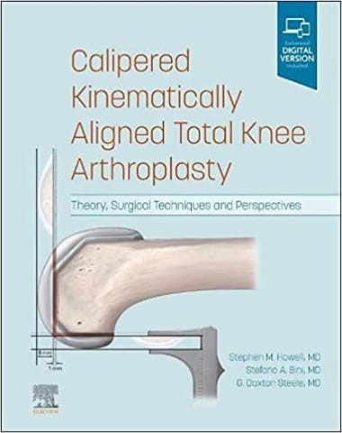 Howell S M Calipered Kinematically Aligned Total Knee Arthroplasty ...