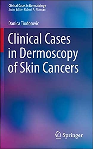 Tiodorovic Clinical Cases in Dermoscopy of Skin Cancers 1st Edition 2020