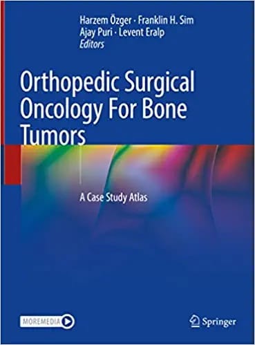 Ozger H Orthopedic Surgical Oncology For Bone Tumors A Case Study Atlas 2022