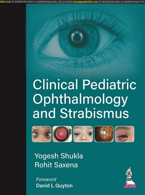 Yogesh Shukla Clinical Pediatric Ophthalmology And Strabismus 1st Edition 2023