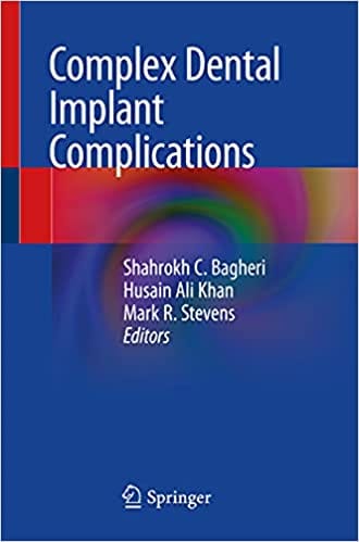 Bagheri S C Complex Dental Implant Complications 2020