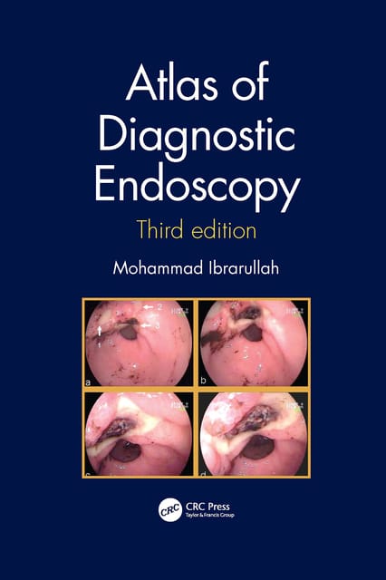 Mohammad Ibrarullah Atlas of Diagnostic Endoscopy 3rd Edition 2021