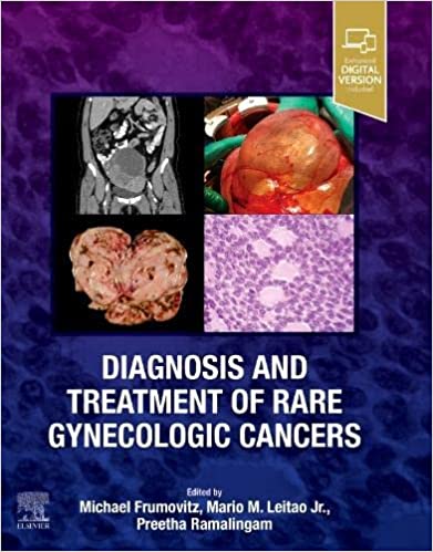 Michael Frumovitz Diagnosis and Treatment of Rare Gynecologic Cancers 2023