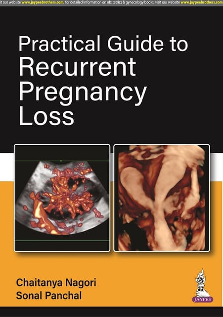 Practical Guide To Recurrent Pregnancy Loss 1st Edition 2023 By Chaitanya Nagori