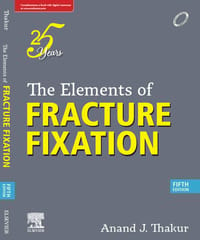 The Elements Of Fraction And Fixations 5th Edition 2023 By Anand J Thakur