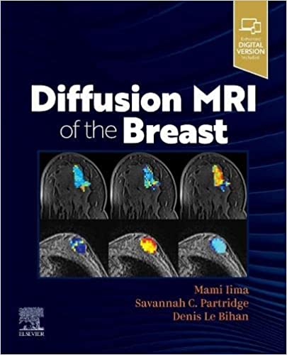 Diffusion MRI Of The Breast With Access Code  2023 By Lima Mami