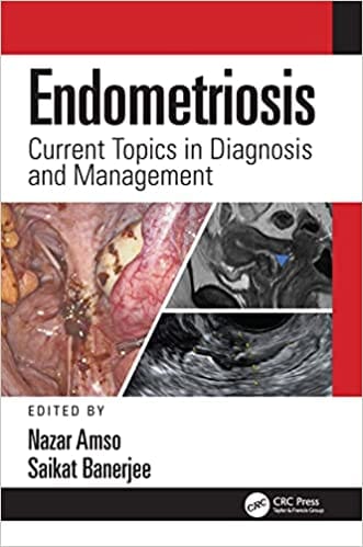 Endometriosis Current Topics in Diagnosis and Management 1st Edition 2022 by Nazar Amso