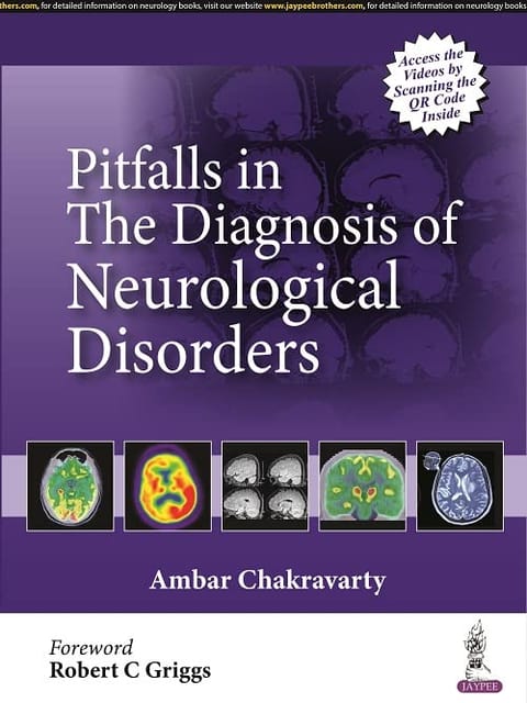 Ambar Chakravarty Pitfalls In The Diagnosis Of Neurological Disorders 1st Edition 2022