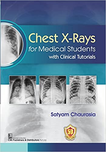 Chest X Rays For Medical Students With Clinical Tutorials 2023 By Chaurasia S