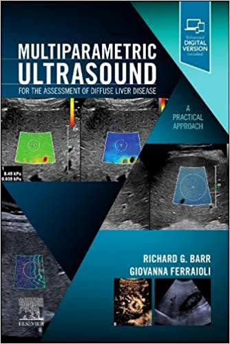 Multiparametric Ultrasound For The Assessment Of Diffuse Liver Disease With Access Code 2024 By Barr RG