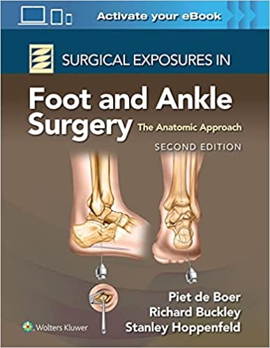 Surgical Exposures In Foot And Ankle Surgery The Anatomic Approach With Access Code 2nd Edition 2023 By Boer P.D.