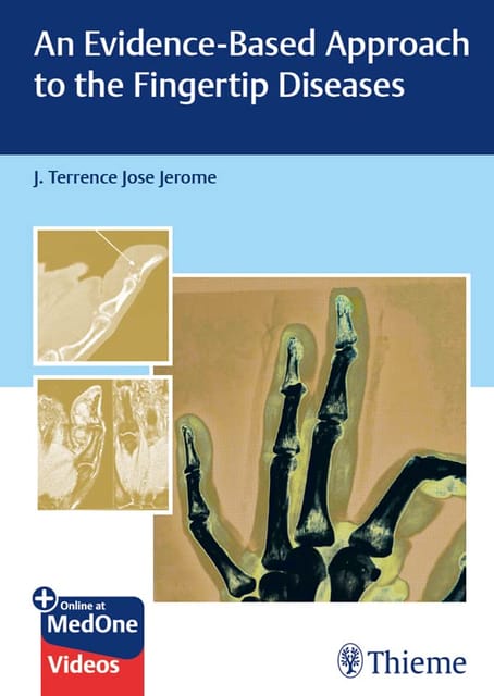 An Evidence-Based Approach To The Fingertip Diseases 1st Edition 2023 By J Terrence Jose Jerome?