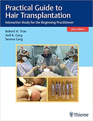 Practical Guide to Hair Transplantation Interactive Study for the Beginning Practitioner 1st Edition 2021 by Robert H True
