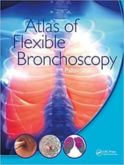 Atlas Of Flexible Bronchoscopy 2022 By Pallav Shah