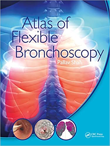 Atlas Of Flexible Bronchoscopy 2022 By Pallav Shah