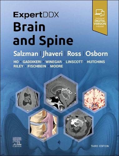 Expertddx Brain And Spine With Access Code 3rd Edition 2024 By Karen L. Salzman