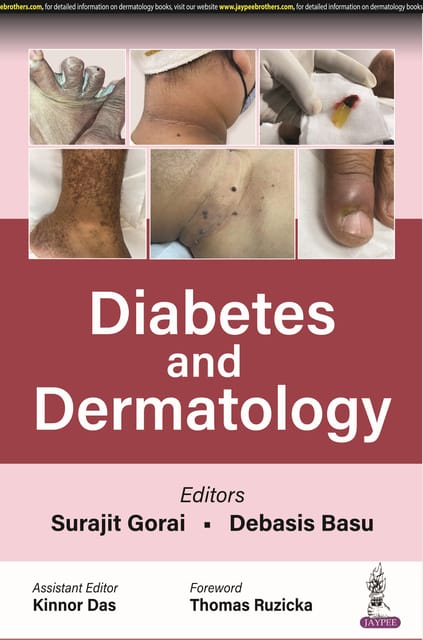 Diabetes and Dermatology 1st Edition 2023 By Surajit Gorai & Debasis Basu