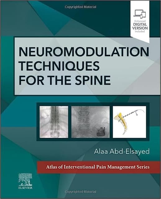Neuromodulation Techniques For The Spine 2024 By Abd-Elsayed A