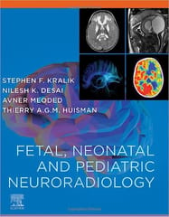 Fetal Neonatal And Pediatric Neuroradiology With Access Code 2024 By Kralik S F