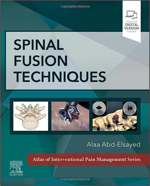 Spinal Fusion Techniques With Access Code 2024 By Abd-Elsayed A