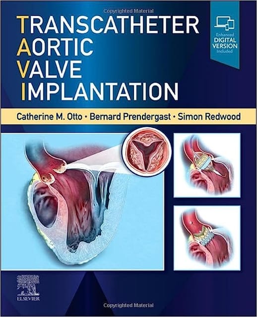 Transcatheter Aortic Valve Implantation With Access Code 2023 By Otto C M