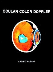 Ocular Color Doppler 
 1st 1995 By Gulani