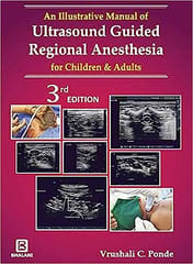 An Illustrative Manual Of 
Ultrasound Guided Region 3rd 2019 By Ponde