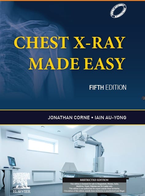 Chest X-Ray Made Easy 5th South Asia Edition 2023 By Jonathan Corne