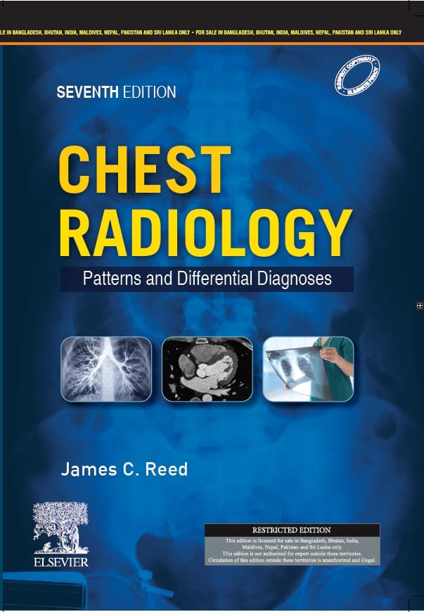 Thomas Reed Radiologist Chest Radiology Patterns and Differential Diagnoses 7th South Asia ...