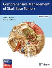 Comprehensive Management of Skull Base Tumors 2nd Edition 2021 BY Ehab Y Hanna
