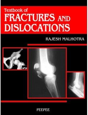 Textbook Of Fracture & Dislocation 1st Edition 2005 By Malhotra