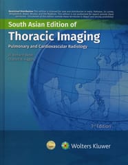 Thoracic Imaging Pulmonary And Cardiovascular Radiology 3rd South Asia Edition 2023 By Webb W.R.