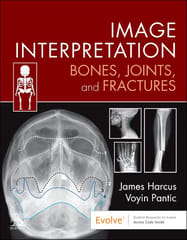 Image Interpretation Bones Joints And Fractures With Access Code 2024 By James Harcus