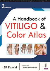 A Handbook Of Vitiligo & Color Atlas 3rd Edition 2024 By Sk Punshi
