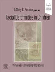 Facial Deformities in Children 1st Edition 2024 By Jeffrey C Posnick