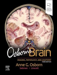 Osborns Brain Imaging Pathology and Anatomy with Access Code 3rd Edition 2024 By Anne G Osborn