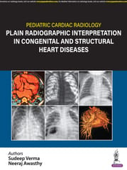 Pediatric Cardiac Radiology Plain Radiographic Interpretation In Congenital And Structural Heart Dis 1st Edition 2024 By Sudeep Verma