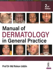 Manual of Dermatology in General Practice 2nd Edition 2024 By Prof Dr Md Rokon Uddin