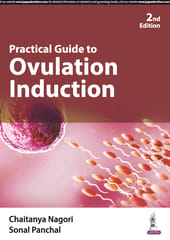 Practical Guide to Ovulation Induction 2nd Edition 2024 By Chaitanya Nagori