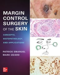 Margin Control Surgery of the Skin Concepts Histopathology and Applications 1st Edition 2023 By Patrick Emanuel &Mark Izzard