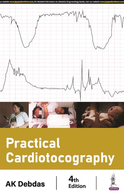 Practical Cardiotocography 4th Edition 2024 By Ak Debdas