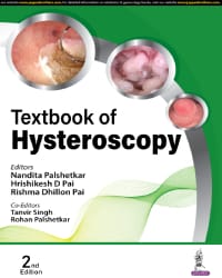 Textbook Of Hysteroscopy 2nd Edition 2024 By Nandita Palshetkar
