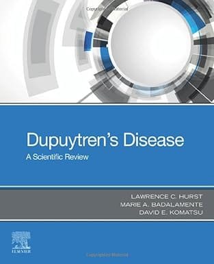 Dupuytrens Disease A Scientific Review  2024 By Hurst LC