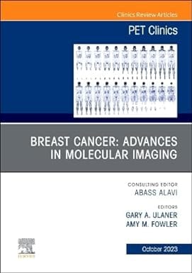 Breast Cancer Advances In Molecular Imaging An Issue Of Pet Clinics  2023 By Ulaner GA