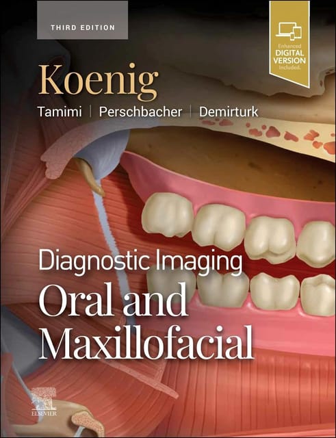 Diagnostic Imaging Oral and Maxillofacial 3rd Edition 2023 By Koenig
